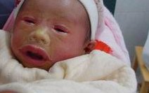 试管婴儿前期检查的时间规划与详尽指南